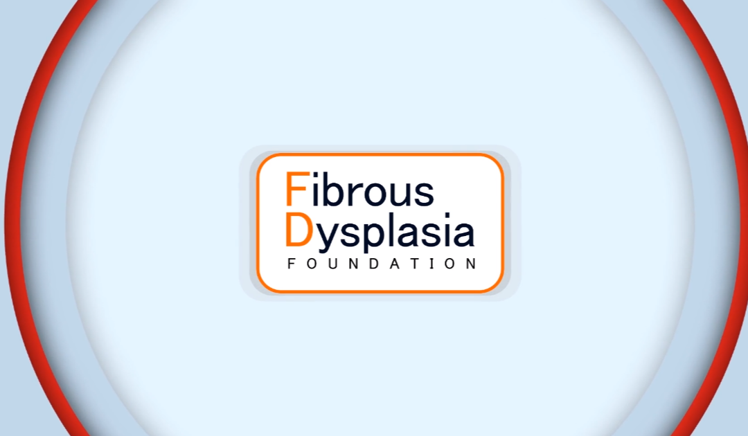 Fibrous Dysplasia